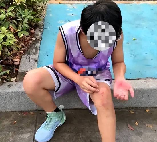 中学体育课自由活动受伤场景图