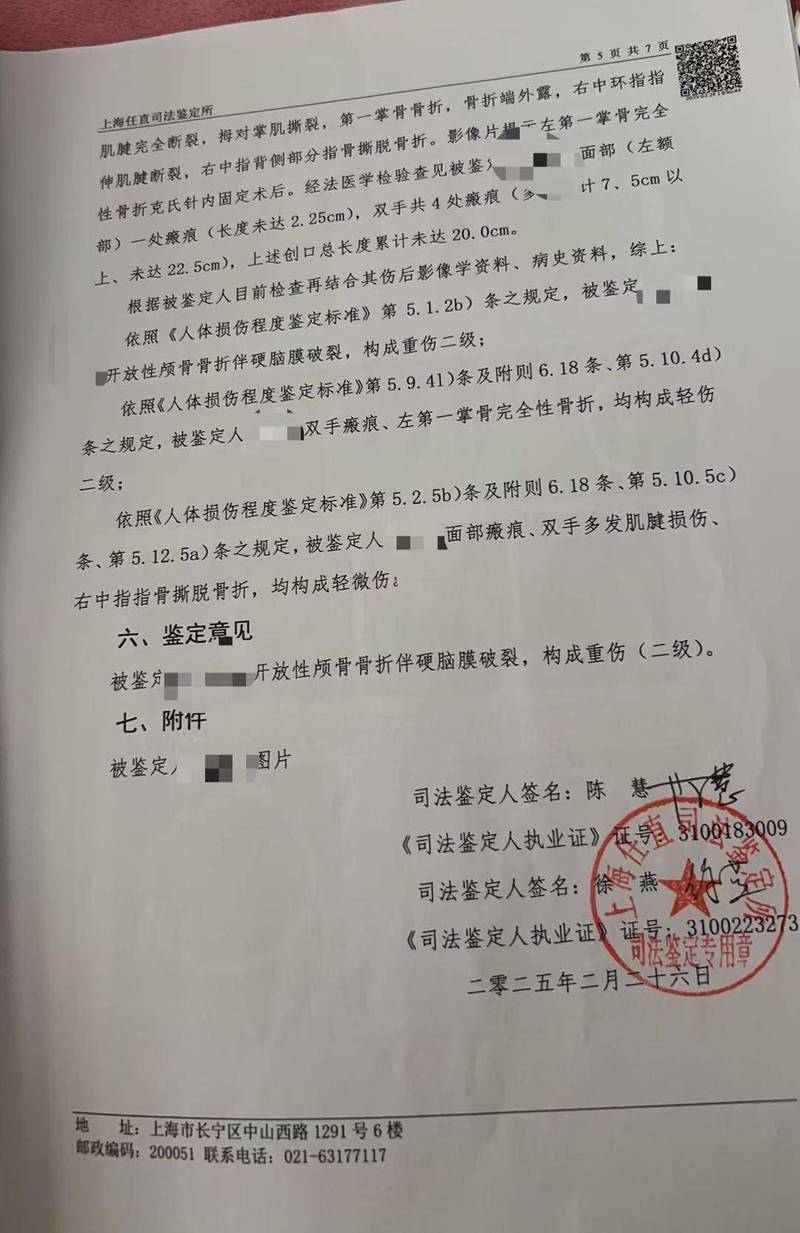 家庭暴力受害人伤情鉴定记录实拍