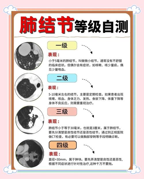 深度学习医疗影像肺结节检测标注示例图