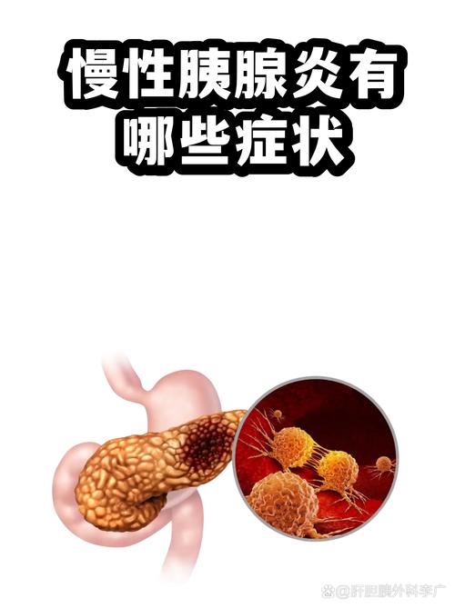 慢性胰腺炎胰腺消化功能减退示意图
