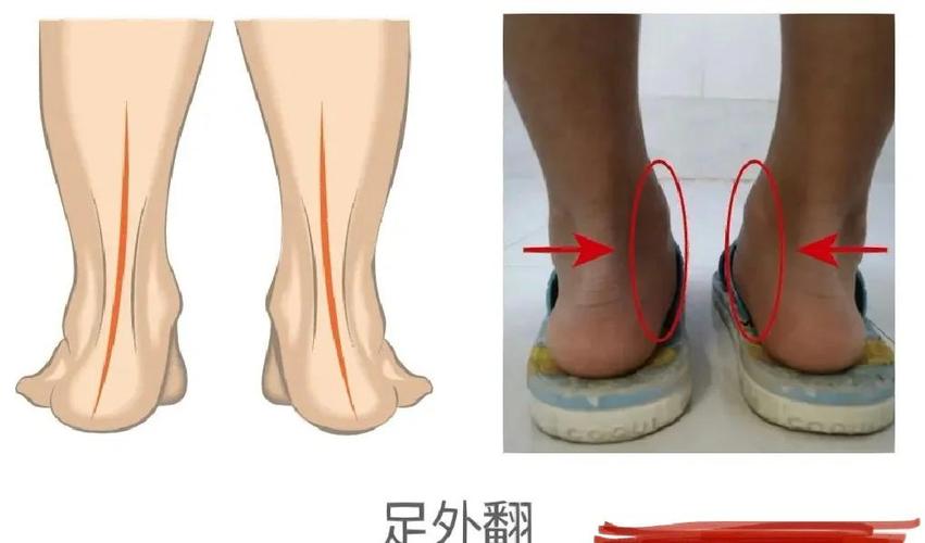 青春期孩子脚部生长突增与旧鞋对比