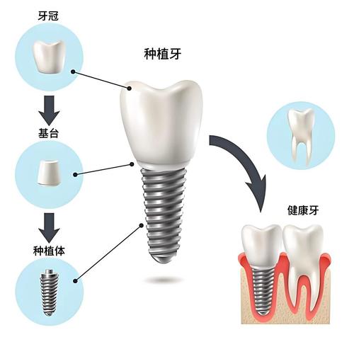 关于标准体,最容易踩的几个误区