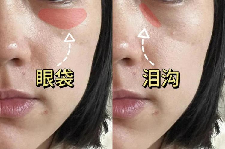 对着镜子轻推下眼睑展示泪沟与眼袋位置关系的日常实拍