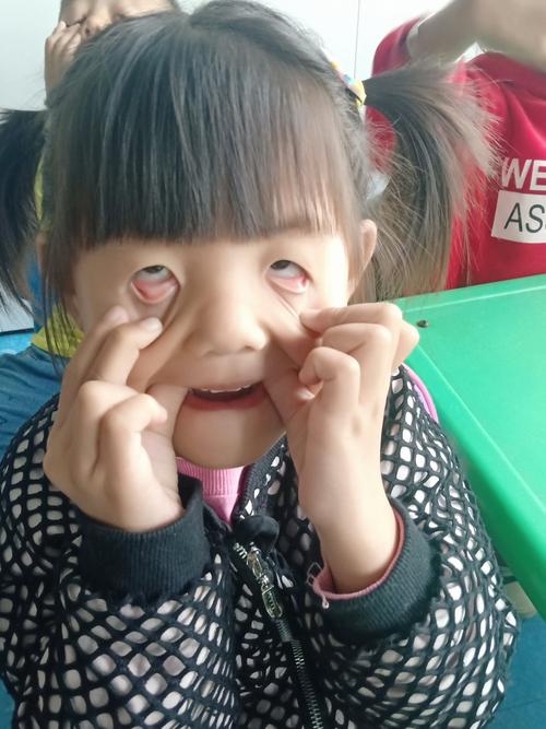 3岁小女孩对着镜子扯自己眼皮的实拍