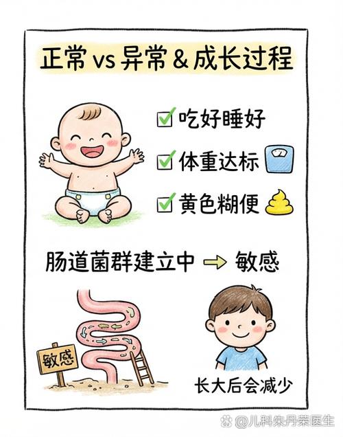 婴儿胃结肠反射原理示意图