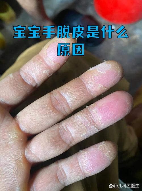 材料黑幕:你手里的“宝宝级”,可能是工业废渣