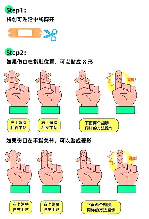 创可贴正确贴法手指关节示意图