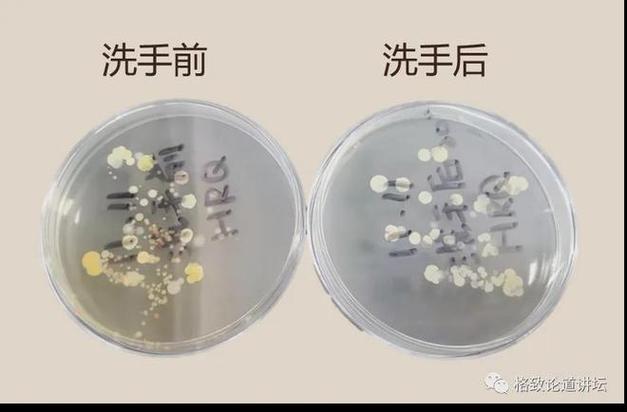 卫生间新旧洗漱用品菌落对比图