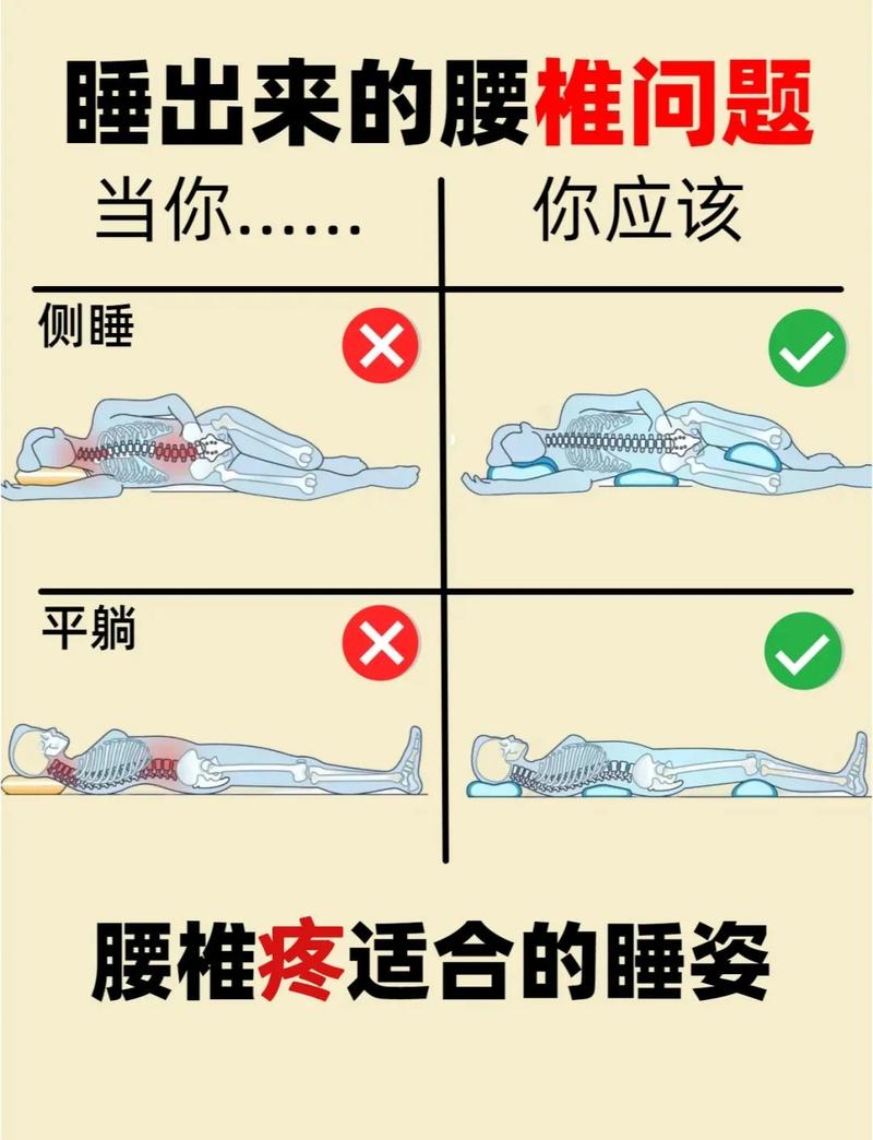 腰椎间盘突出人群不同硬度床垫睡姿示意图