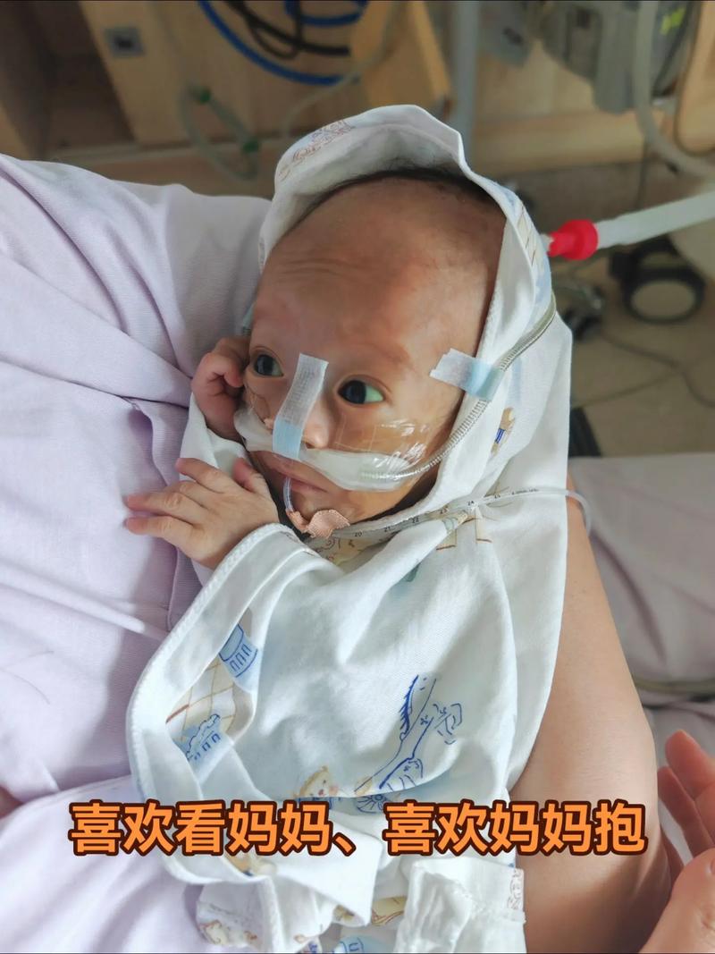 NICU：每天都是过关