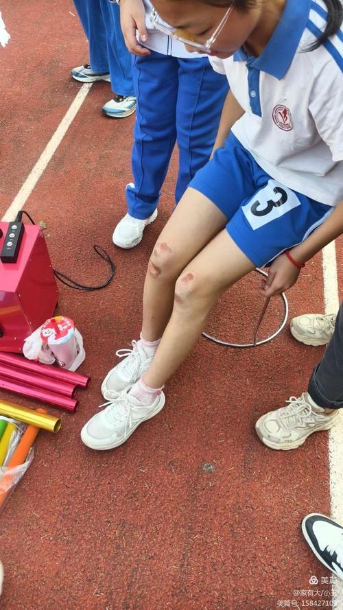 小学运动会跑道上女生膝盖擦伤后继续跑步的抓拍