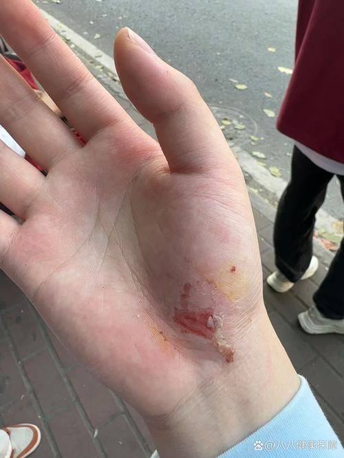 上个月刚碰到的真事