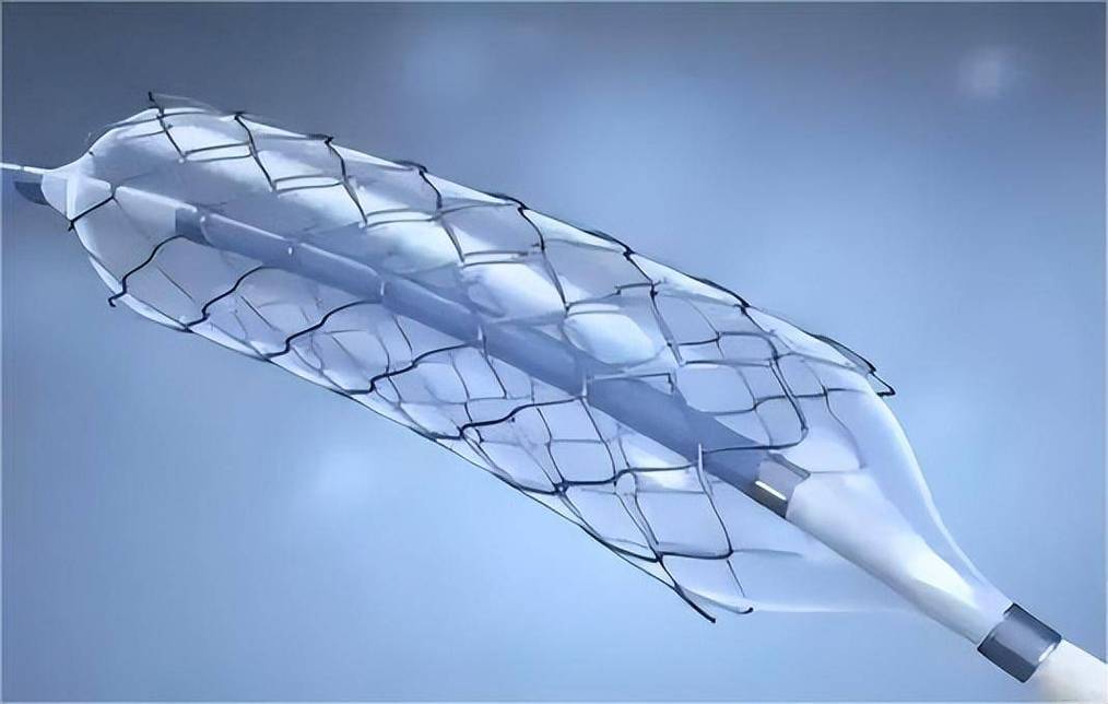 国产可降解心血管支架精度检测场景