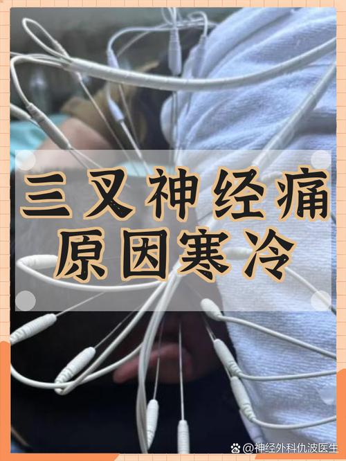 冬季三叉神经痛患者戴口罩面部保暖场景图