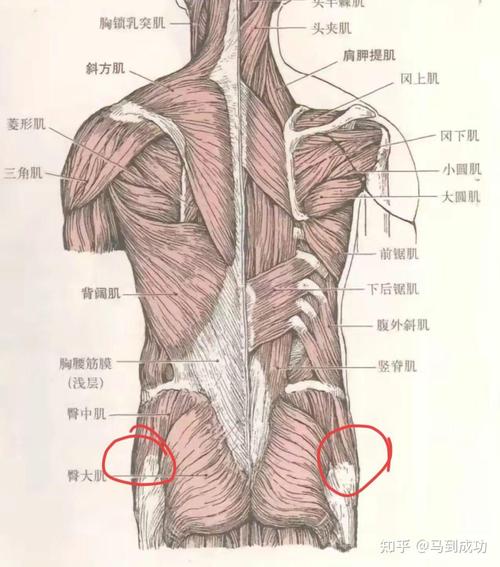 久坐人群腰背肌肉紧张状态示意图