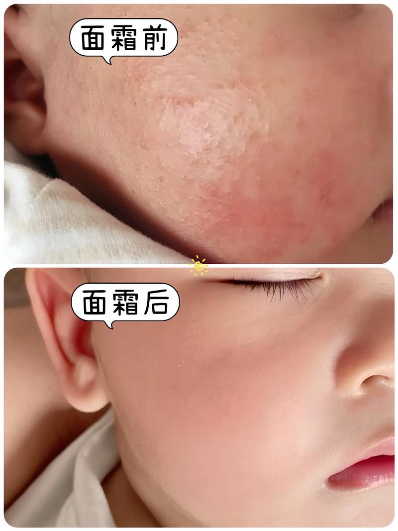 保留婴儿自然皮肤质感的后期对比图