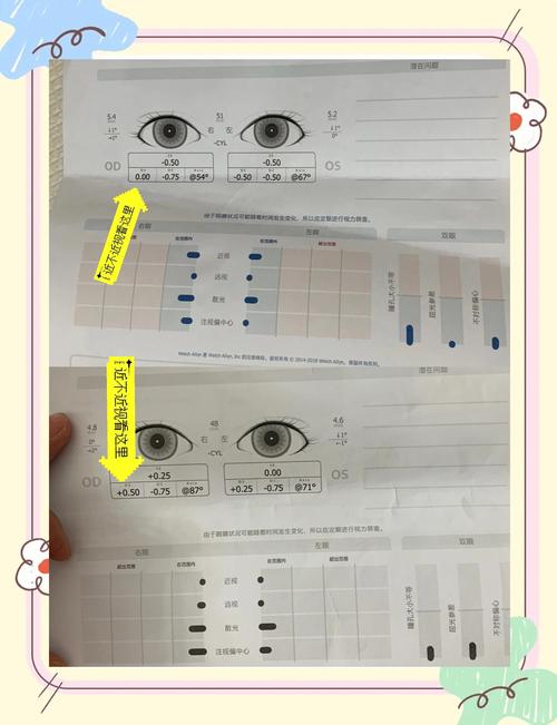 儿童眼科检查远视储备记录单