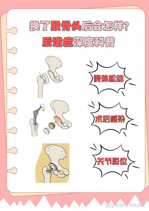 换完还有收尾，别留后遗症