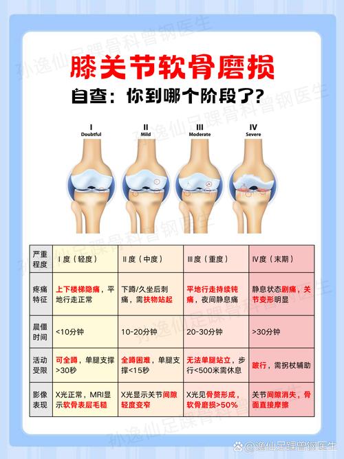 膝关节骨关节炎平地上下楼受力对比图