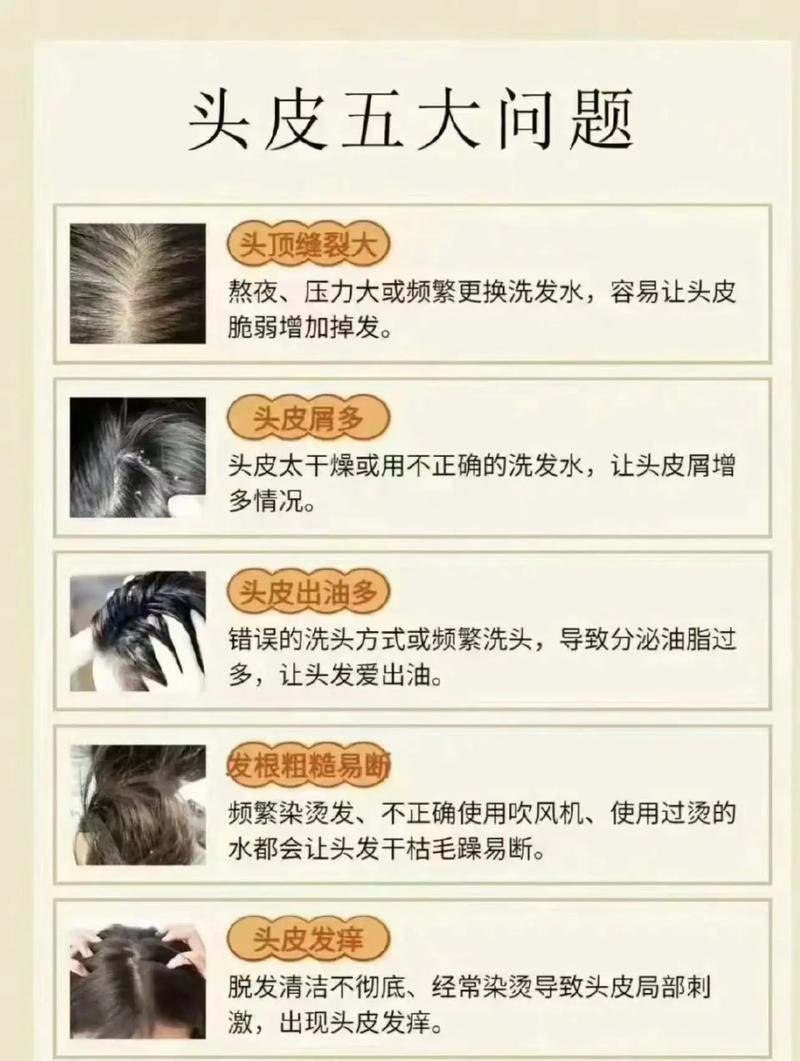 六、那些让你头大的问题，这里一次性说清
