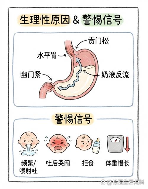 新生儿胃食管结构溢奶原理示意图