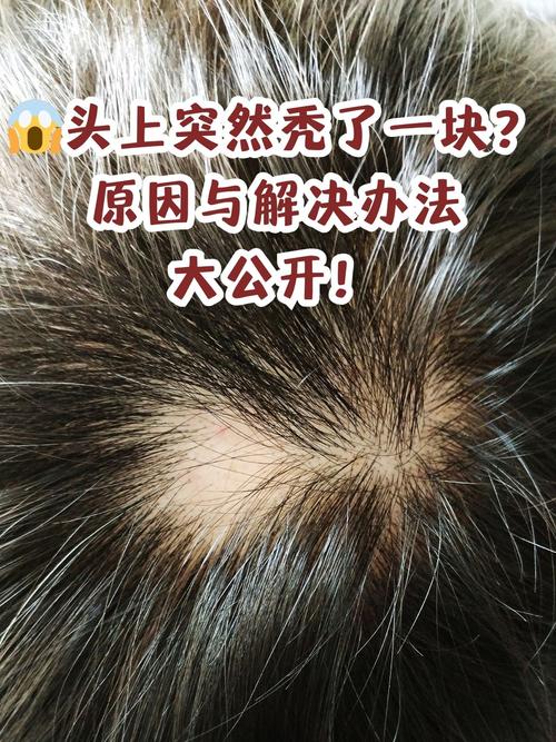 还有比这两样更让人头秃的？