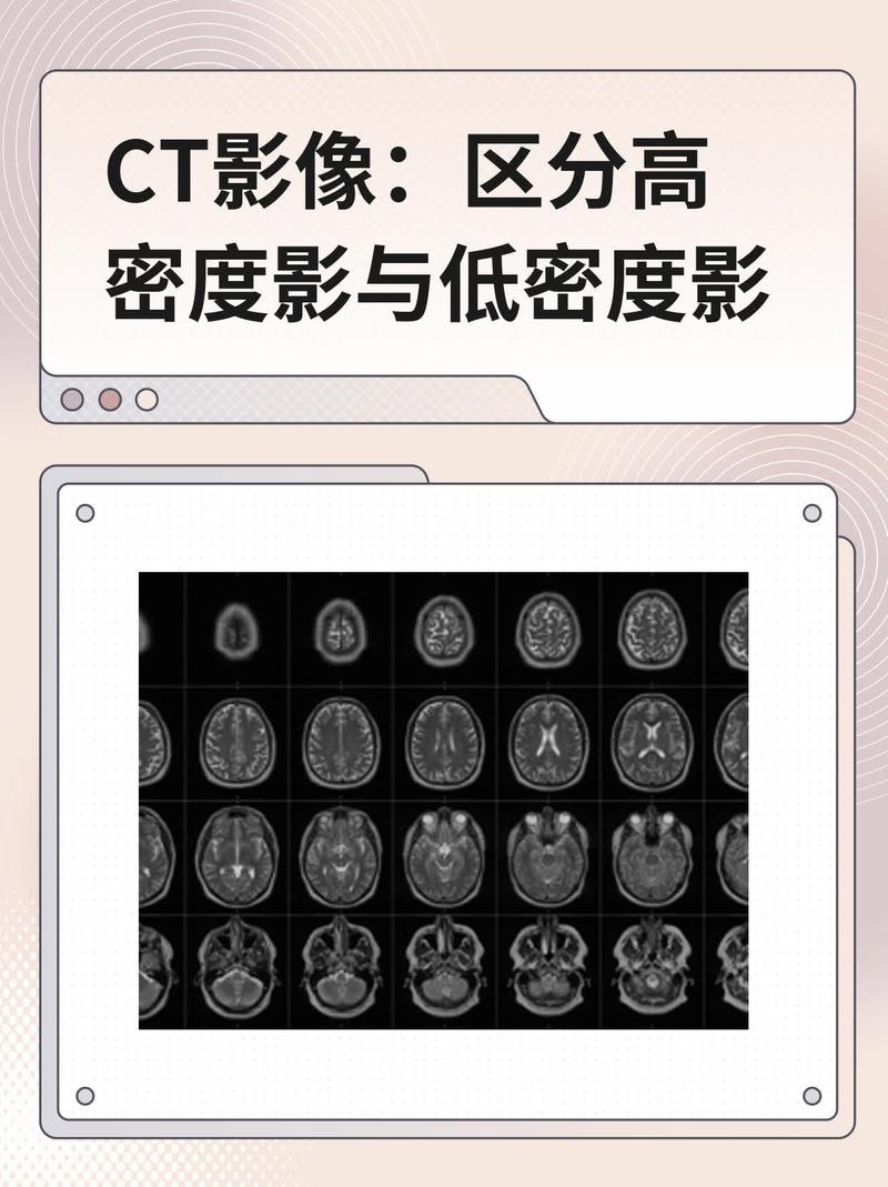 冷等静压坯体内部密度分布CT扫描伪彩图