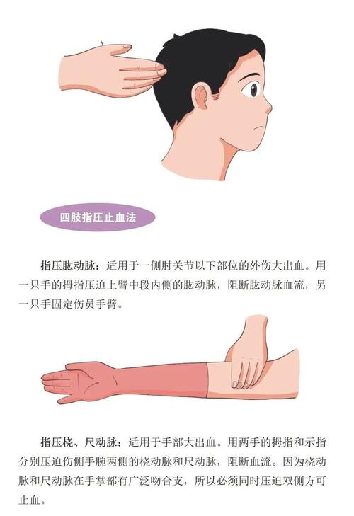 幼儿摔伤伤口正确按压止血操作图