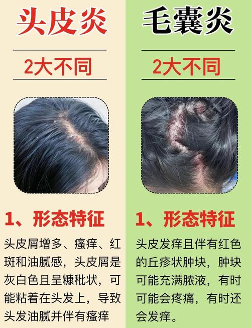 健康头皮与受损头皮毛囊对比图
