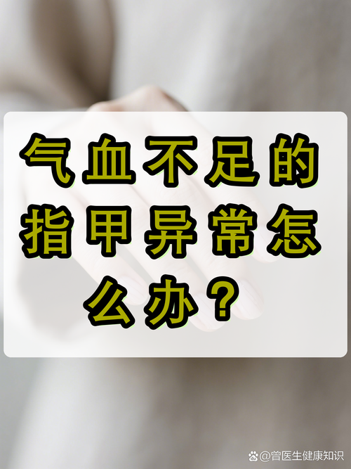 几个容易忽略的小坑