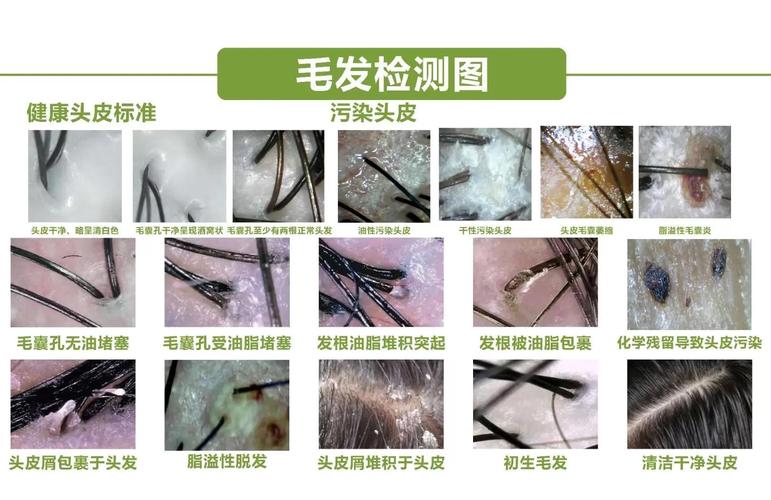 不同头皮肤质状态自测对比图