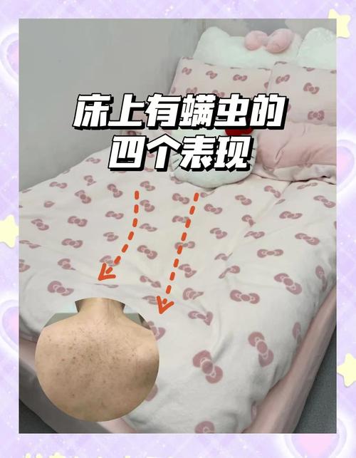 居家床上尘螨常见分布位置图
