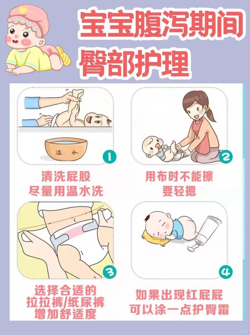 婴儿腹泻时护理步骤示范图