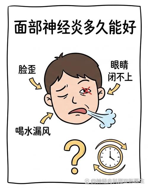 面神经炎患者眼部遮盖护理示意图