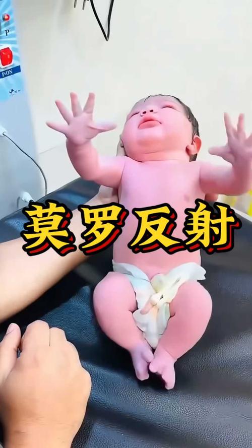 新生儿莫罗反射发作瞬间抓拍