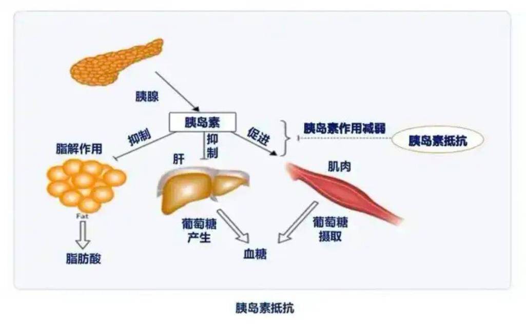 腹部脂肪堆积与胰岛素分泌节奏关系示意图