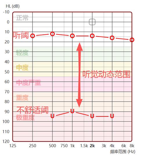 犬类与人耳听觉范围对比示意图