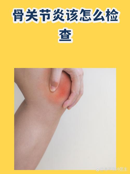 真查出来关节炎，我们该怎么办？