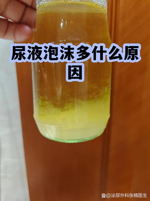 泡沫下面，藏着哪些绕不开的坎