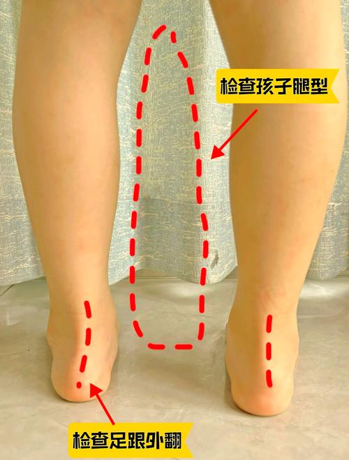 宝宝错误踮脚站立正确站立对比图