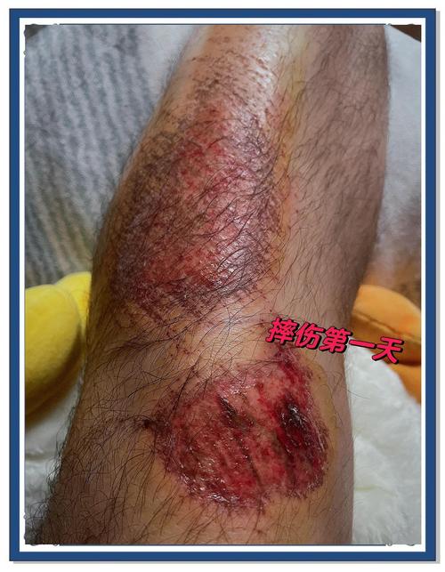 日常轻度磕碰严重程度判断图