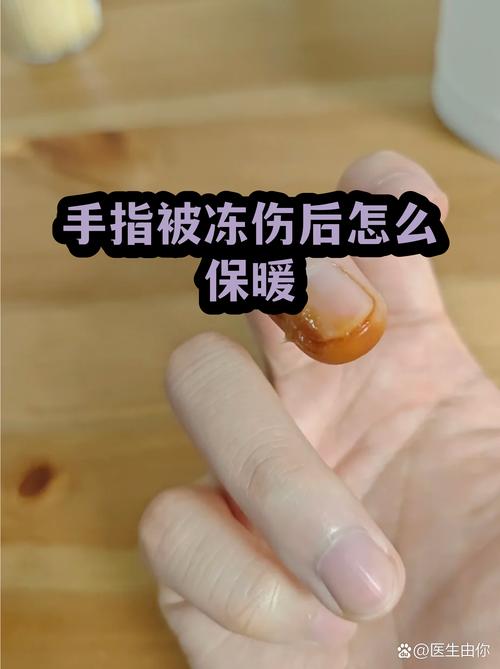 常见冬季错误保暖方式实拍图