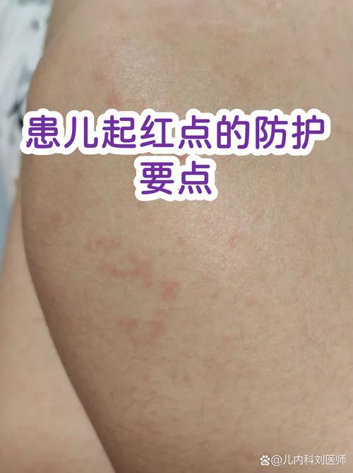 宝宝穿衣问题的就医红线