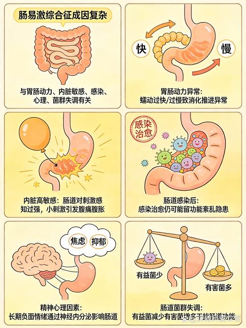 肠易激综合征肠脑情绪联动示意图