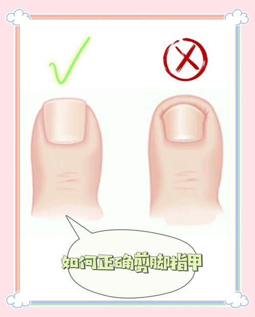 日常常见错误指甲养护行为示意图