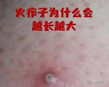 火到发烫的当下，藏着三个容易踩的坑