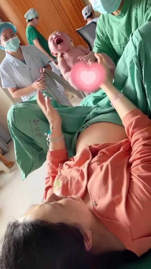 顺产新生儿出生后亲子早接触场景