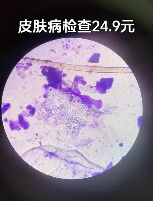 猫皮屑过敏原放大显微镜图