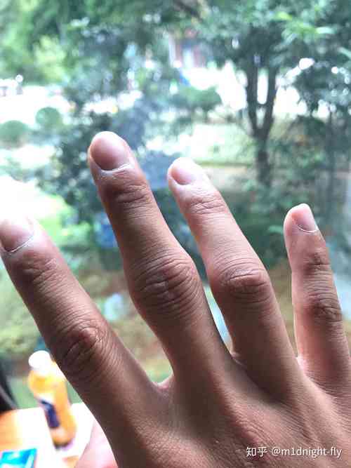 真碰到疑似情况,怎么留后手