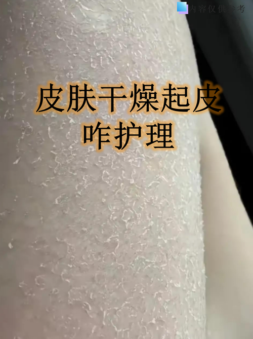 干燥季节全身皮肤保湿护理场景